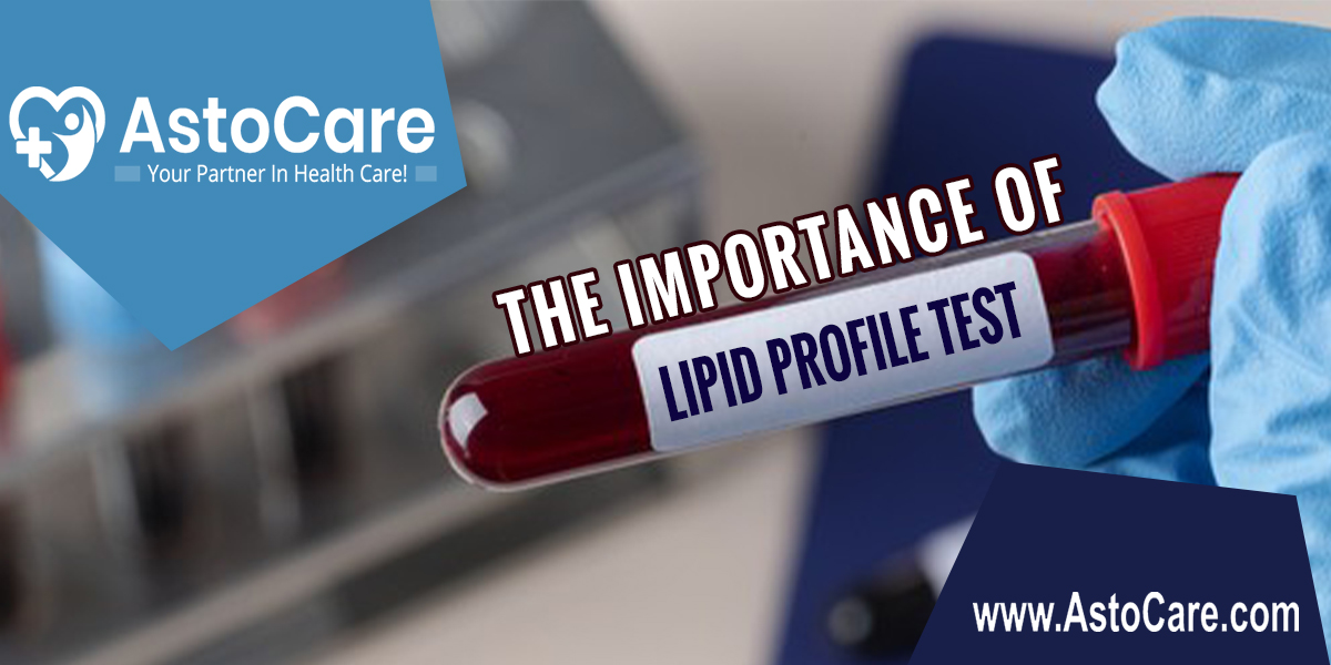 The Importance of Lipid Profile Test